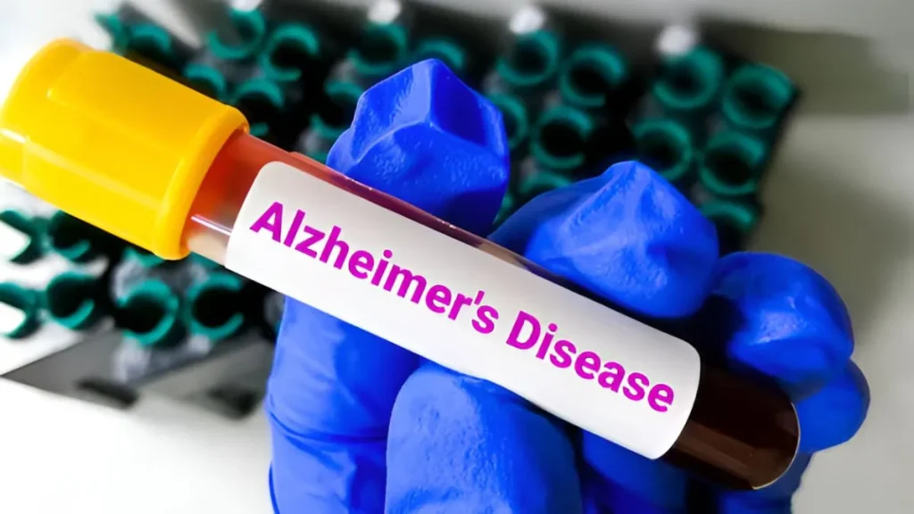 new-model-to-detect-the-risk-of-Alzheimer-1763172108348