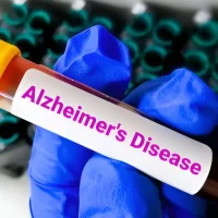 new-model-to-detect-the-risk-of-Alzheimer-1763172108348